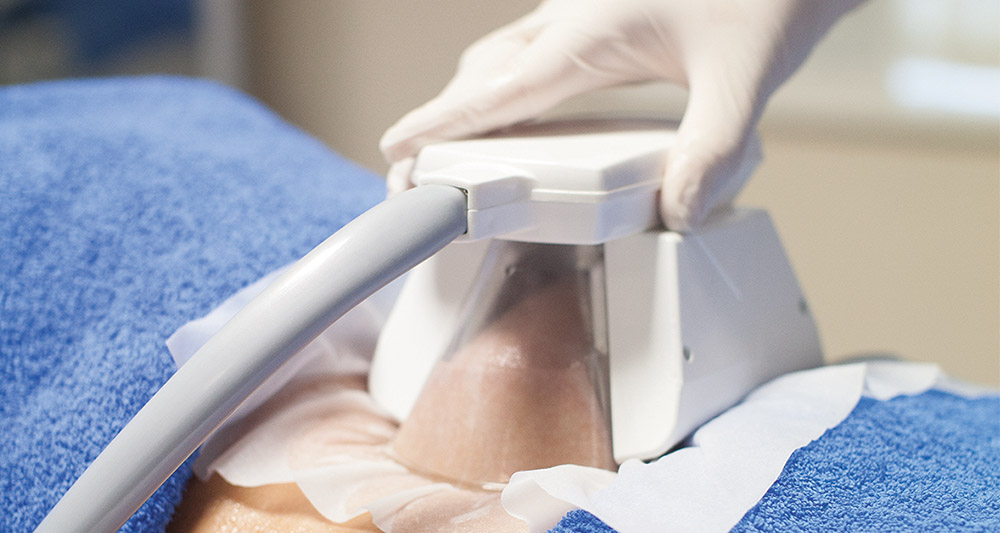 How Fat Freezing and HIFU Work Together? 2 Multiple Areas in One Session HIFU and Fat Freezing Northwood