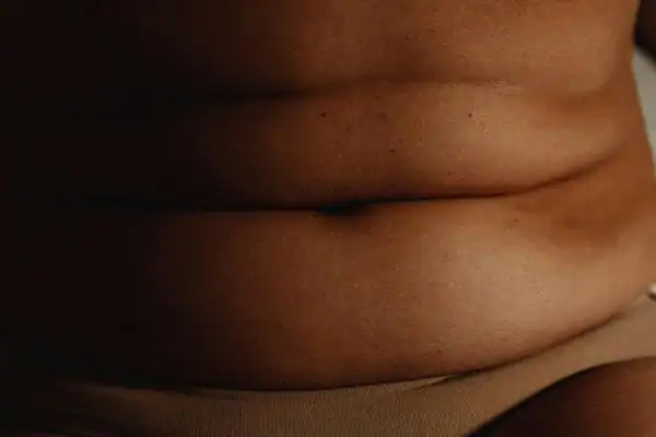 The Hidden Connection: How Stress Shapes Your Fitness and Body Composition 3 image of what stress can do on the stomach area and how Lipo 360 Northwood can help to change your body shape.