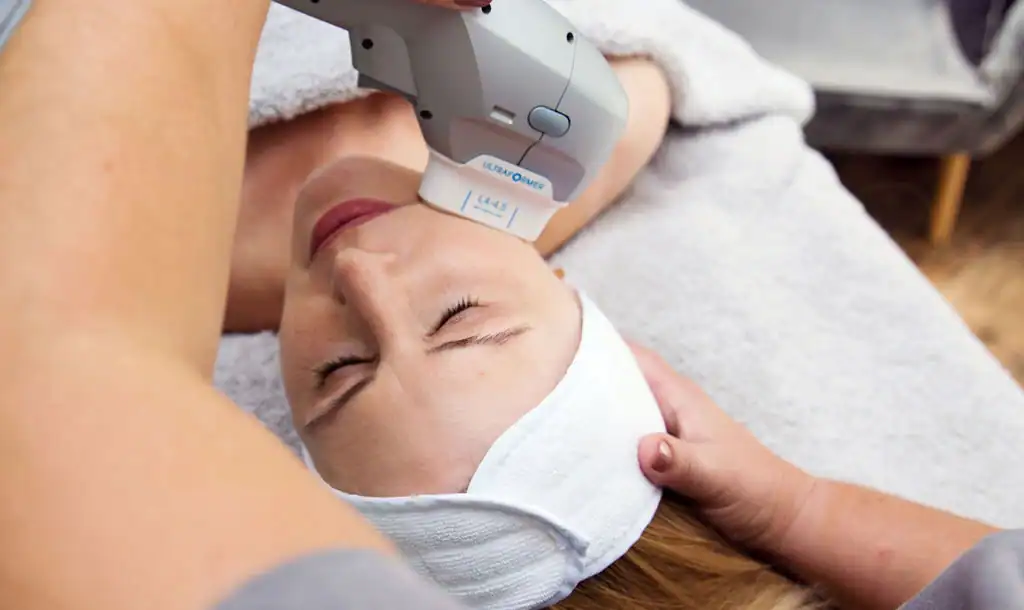 Discover the Perfect Duo: RF Microneedling and HIFU 1 Image of Morpheus8 And HIFU Northwood combined treatment